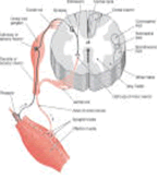 בדיקת EMG –NCV