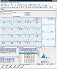 בדיקת EMG –NCV