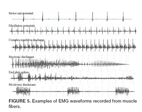 בדיקת EMG –NCV