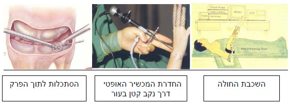 מבט בתוך מפרק שורש היד