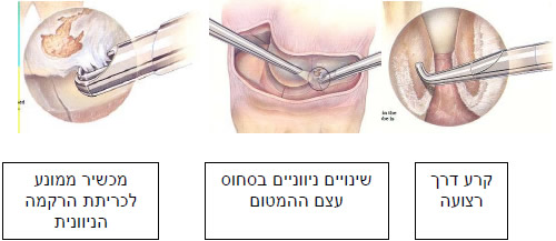 אינדיקציות לארטרוסקופיה אבחנתית של שורש היד